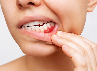 歯周病は歯ぐきだけではなく全身にかかわる病気です